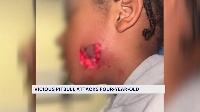 Story image: Pit bull attack sends 4-year-old to the hospital