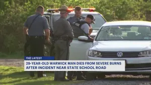 Police: 29-year-old man dies after burning incident at Warwick Park