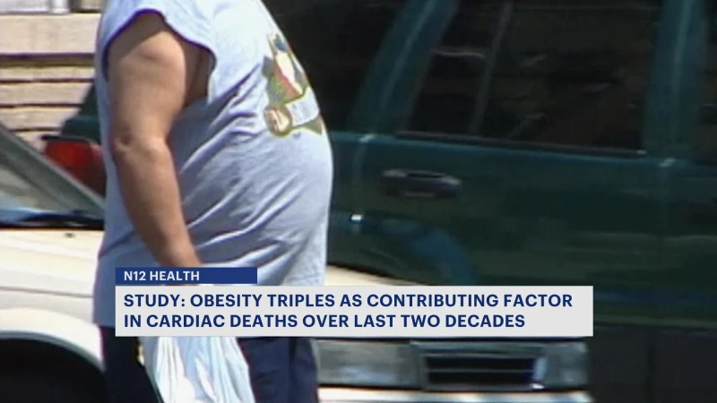 Story image: Obesity's role in cardiac deaths explored in new study
