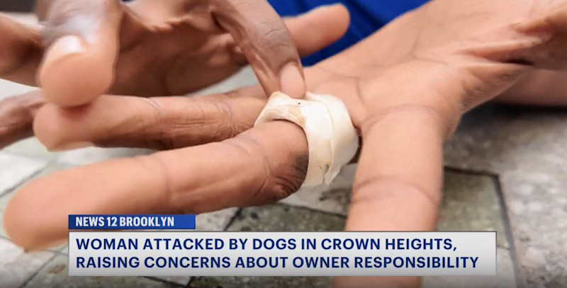 Story image: Crown Heights woman calls for greater accountability after alleged dog attack