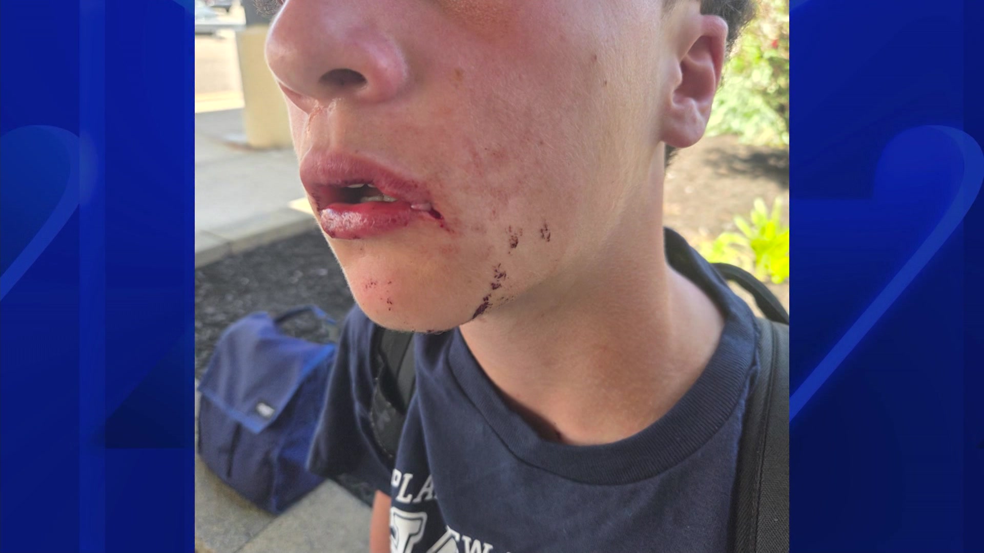 Teen Attacked MS 060526_2026-06-05-22-13-01