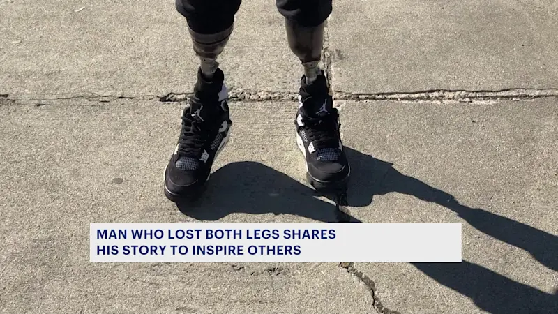 Story image: Survivor of double leg amputation shares his story to inspire others facing hardships