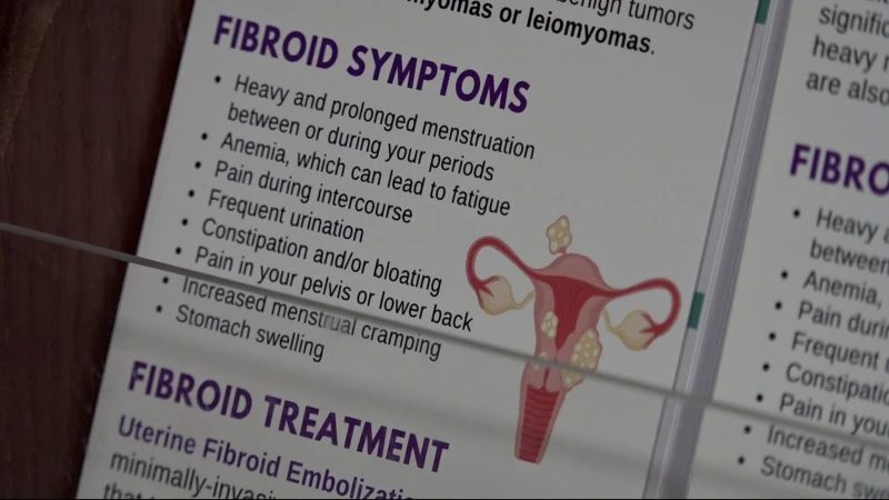 Story image: Doctors raising awareness about fibroids that impact millions of women