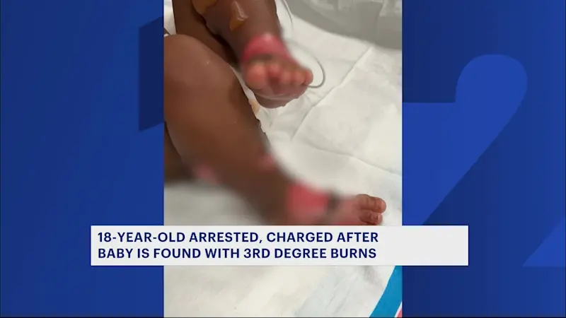 Story image: Woman arrested, charged after baby girl severely burned while under her watch